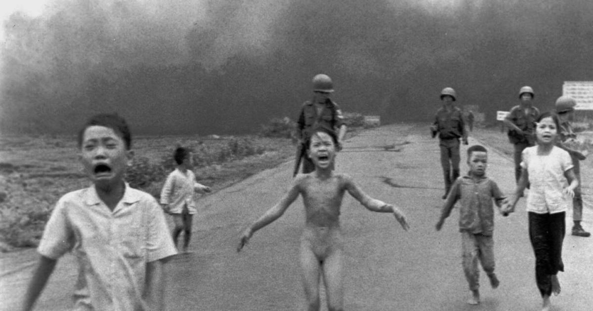 <h6>Laser treatment for the living symbol of Vietnam napalm attack</h6>Miami: Forty-three years ago there was a photograph of a little girl from Vietnam running naked afte...